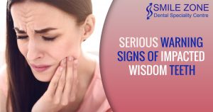 Serious Warning Signs of Impacted Wisdom Teeth