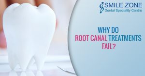 Why do Root Canal Treatments Fail?