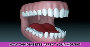 How can diabetes affect your mouth?