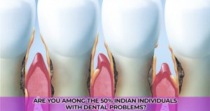 Are you among the 50% Indian Individuals with Dental problems?