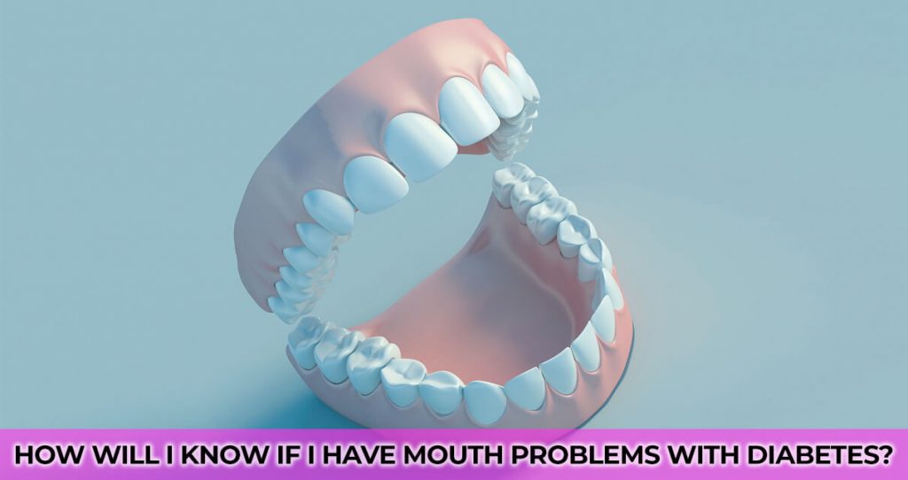 How will I know if I have mouth problems with diabetes?