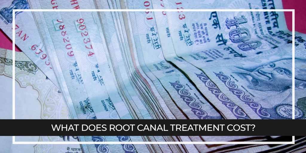 What does Root Canal Treatment cost?