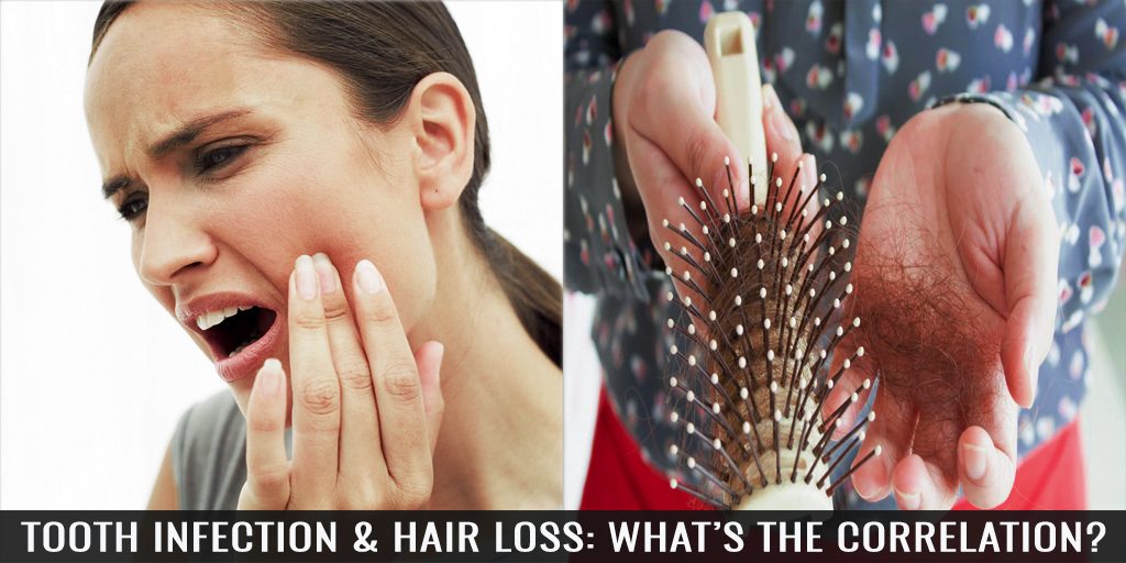 Tooth Infection & Hair Loss: What’s the Correlation?