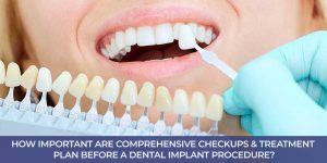 How Important Are Comprehensive Checkups & Treatment Plan Before a Dental Implant Procedure?