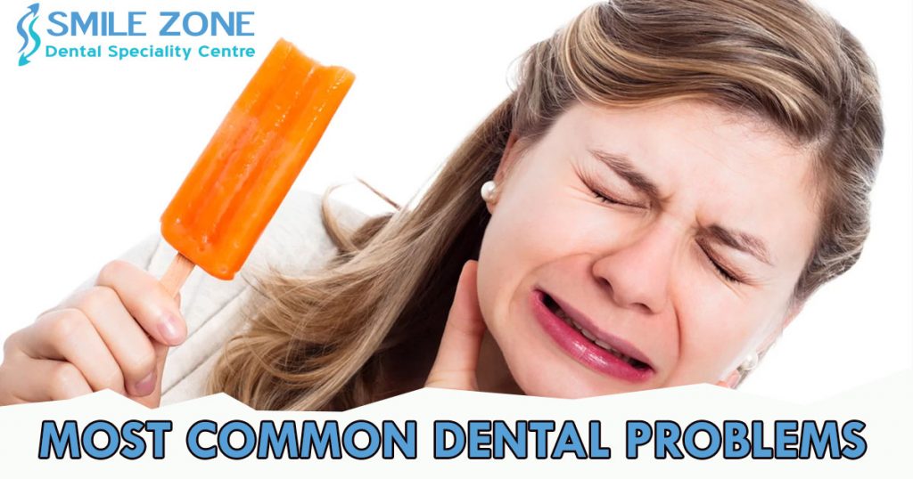 Most Common Dental Problems