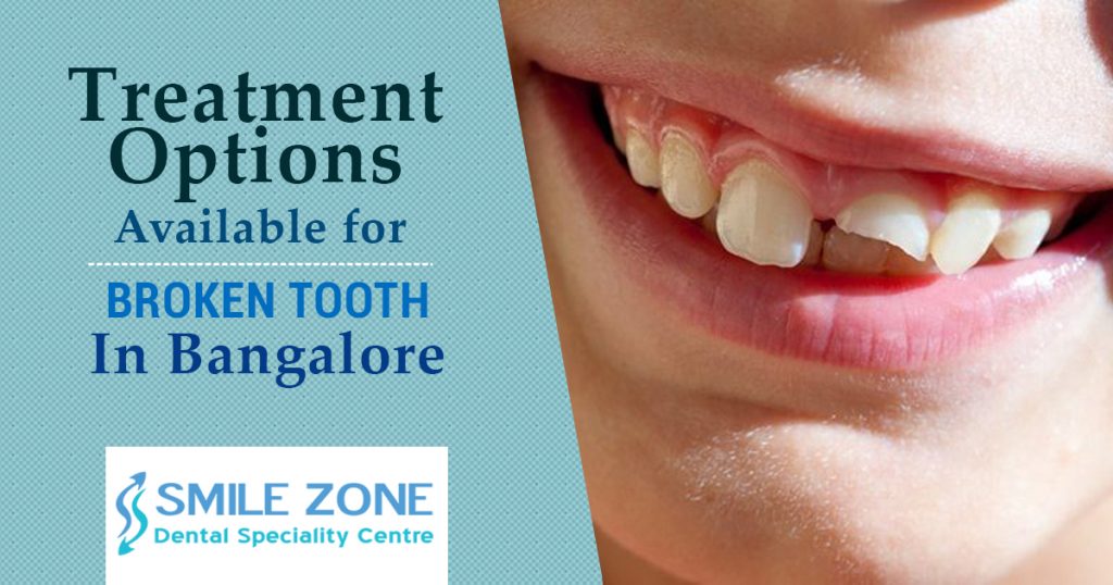 Treatment Options Available for Broken Tooth In Bangalore