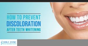 how to prevent discoloration after teeth whitening