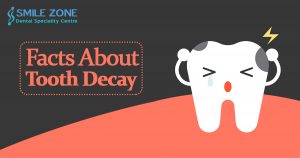 Facts About Tooth Decay