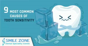 9 Most common causes of Tooth Sensitivity