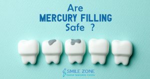 Are Mercury Filling Safe