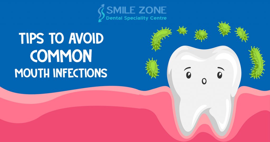 Tips To Avoid Common Mouth Infections