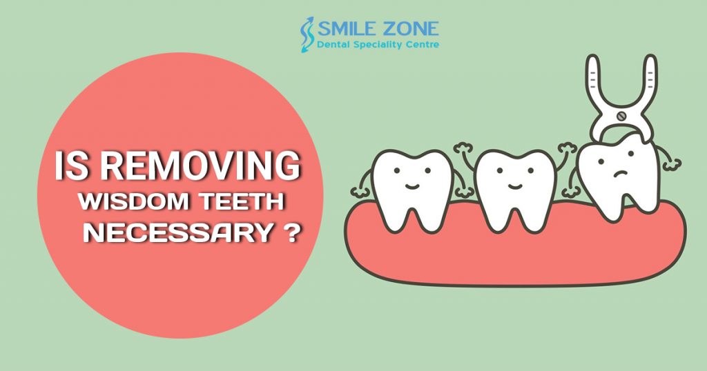 Is removing Wisdom Teeth Necessary