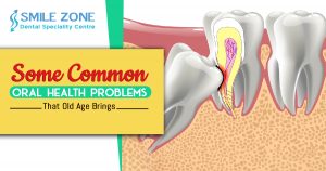 Some Common Oral Health Problems that old Age Brings