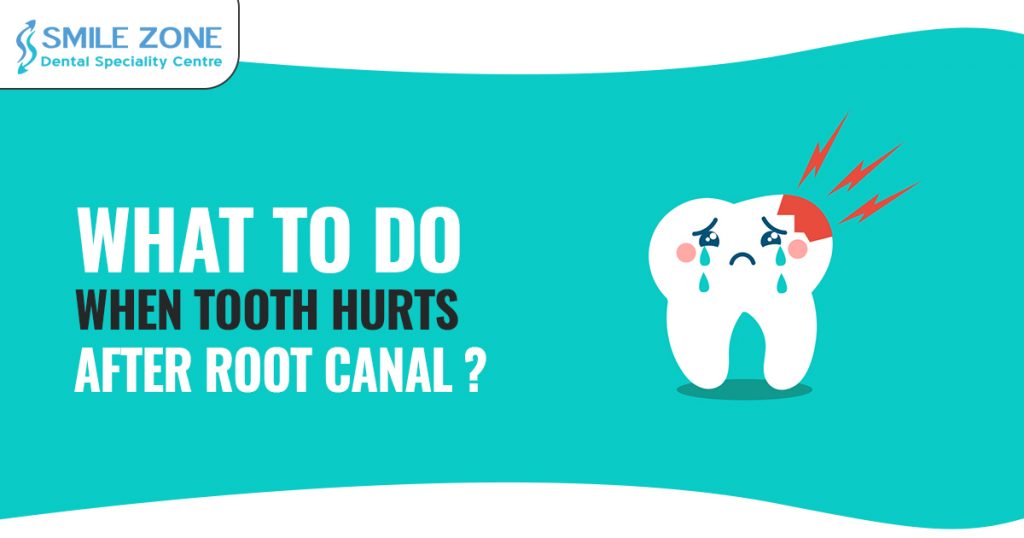 What to Do when tooth hurts after root canal