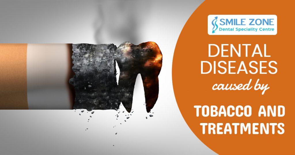 Dental diseases caused by tobacco and treatments