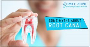 Some Myths about Root canal