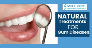 Natural treatments for gum diseases