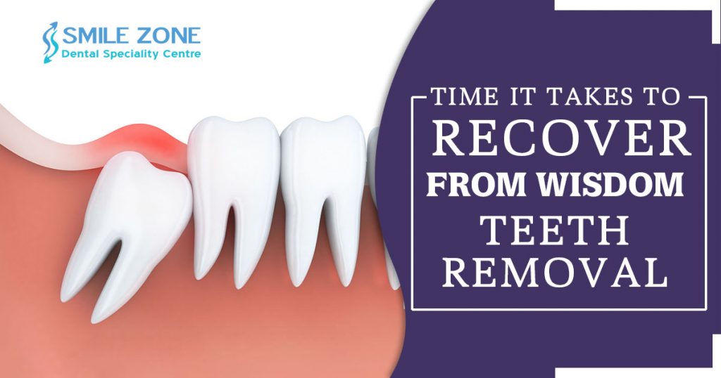 Time it takes to recover from wisdom teeth removal