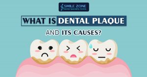 What is dental plaque and its causes
