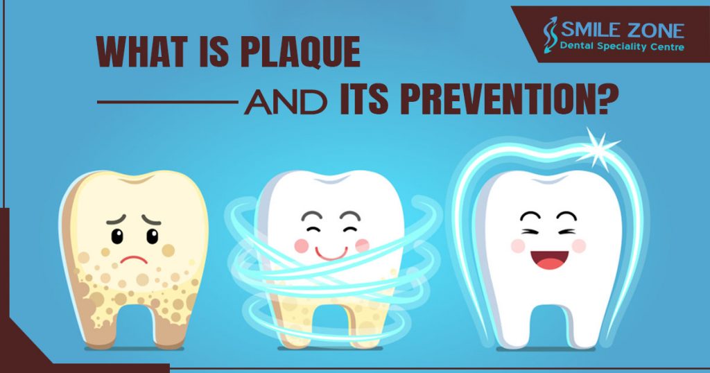 What is plaque and its prevention