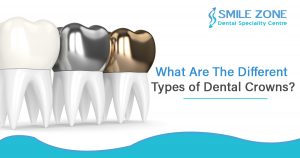 What are the different Types of dental crowns
