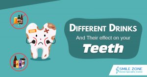 Different Drinks and their effect on your teeth