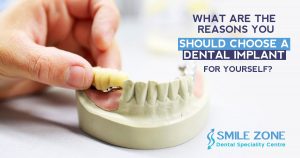 What are the reasons you should choose a dental implant for yourself