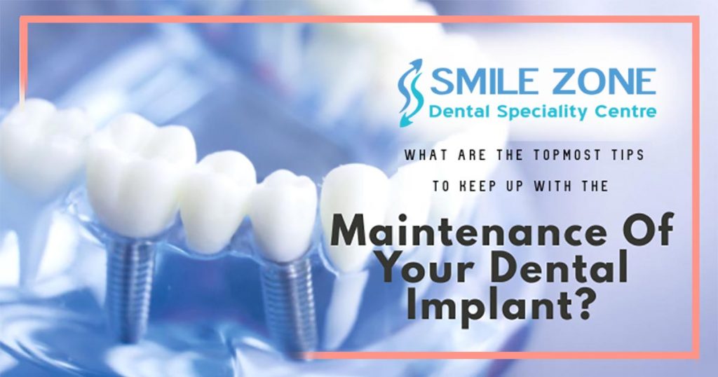 What Are The Foremost Tips To Keep Up With The Maintenance Of Your Dental Implant