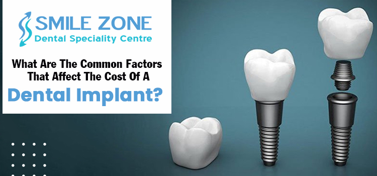 What-are-the-common-factors-that-affect-the-cost-of-a-dental-implant