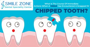 What-is-the-course-of-immediate-actions-when-a-child-has-encountered-a-snapped-or-chipped-tooth
