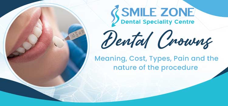 Dental Crowns - Meaning, Cost, Types, Pain and the nature of the procedure