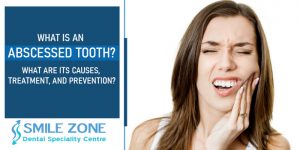 What is an abscessed tooth? What are its causes, treatment, and prevention?