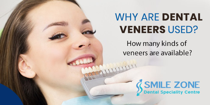 Why are dental veneers used? How many kinds of veneers are available?