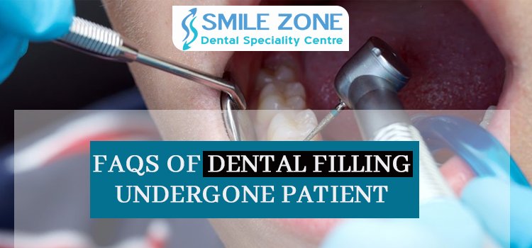FAQs of Dental filling undergone patient