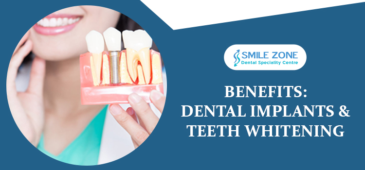 dental implant specialist in whitefield