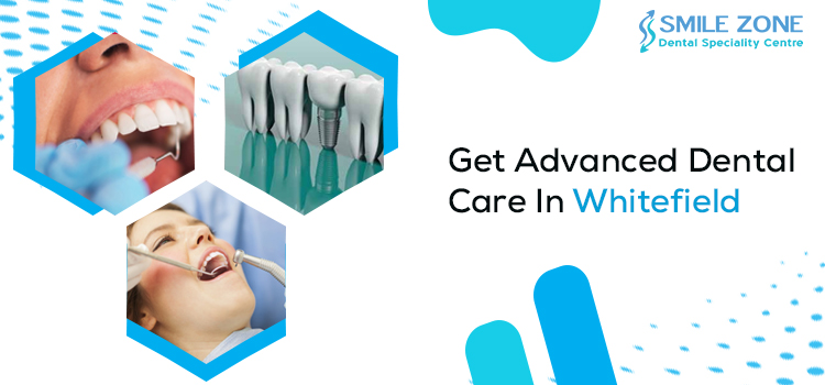 Get Advanced Dental Care In Whitefield