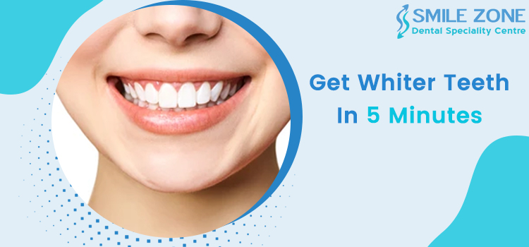 Get Whiter Teeth In 5 Minutes