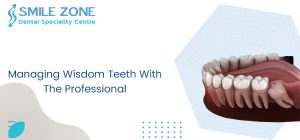 Managing Wisdom Teeth With The Professional
