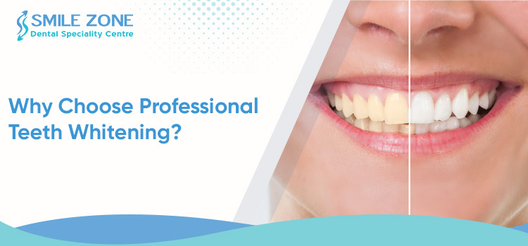 Why Choose Professional Teeth Whitening