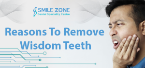 Reasons To Remove Wisdom Teeth