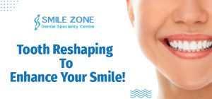 Tooth Reshaping To Enhance Your Smile_