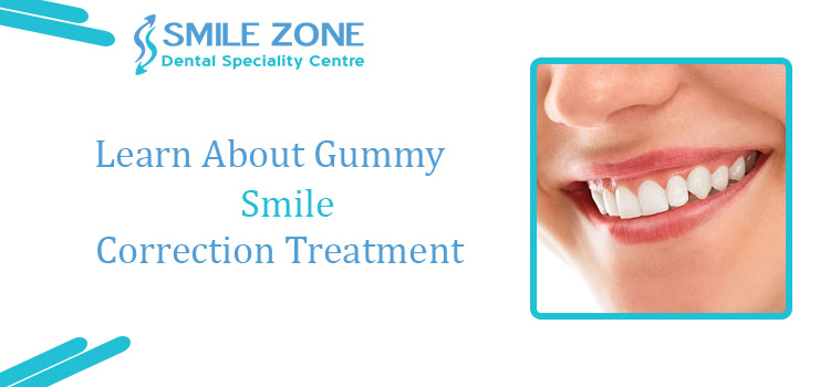 Learn About Gummy Smile Correction Treatment
