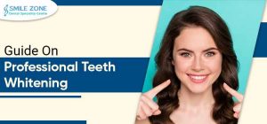 Guide On Professional Teeth Whitening