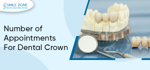 Dental-Crown.