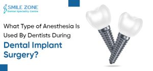 What Type of Anesthesia Is Used By Dentists During Dental Implant Surgery