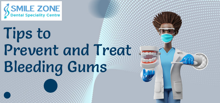Tips to Prevent and Treat Bleeding Gums