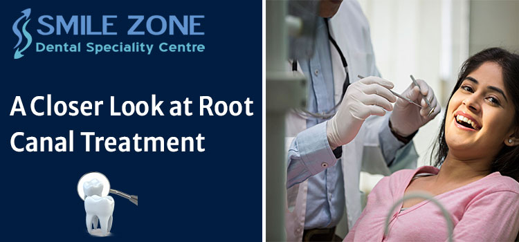 A-Closer-Look-at-Root-Canal-Treatment
