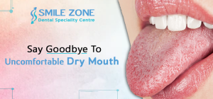 Say Goodbye To Uncomfortable Dry Mouth